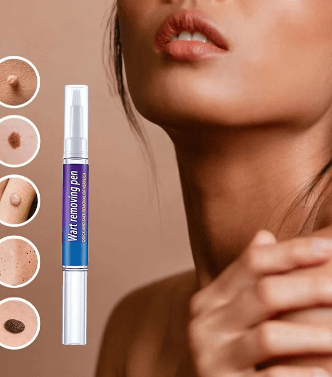 Advanced Herbal Wart Skin Tags Remover - Trendart
