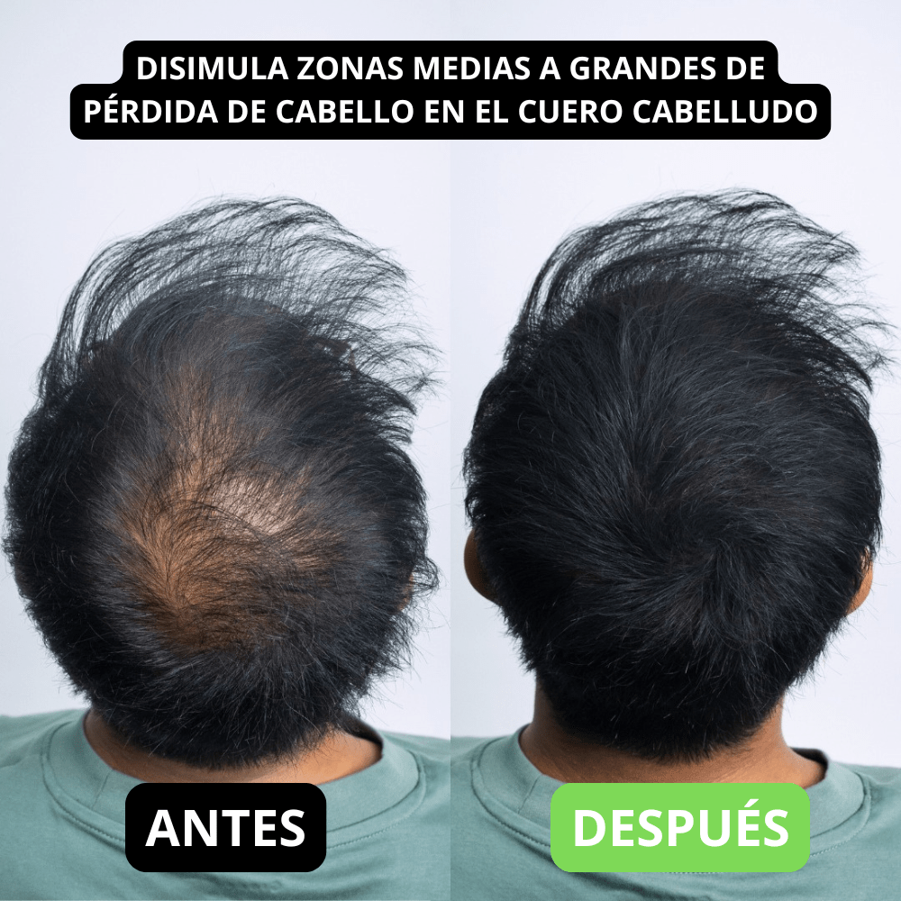 Hair Volume Powder for Men & women - Trendart