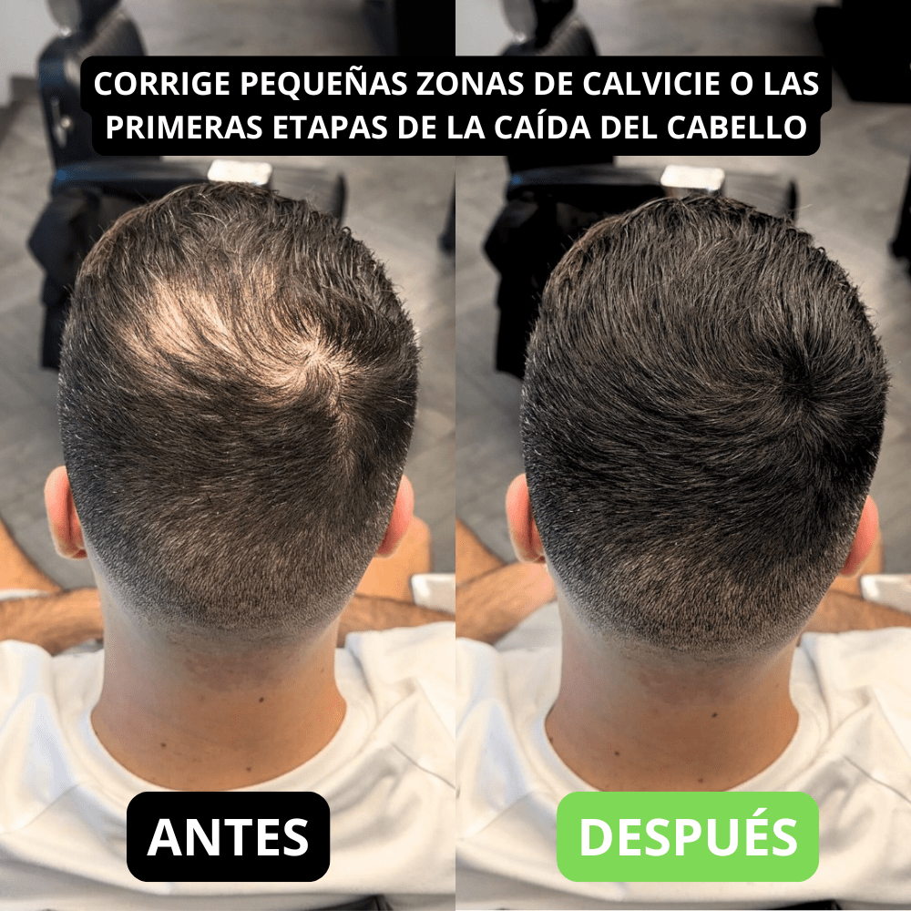 Hair Volume Powder for Men & women - Trendart