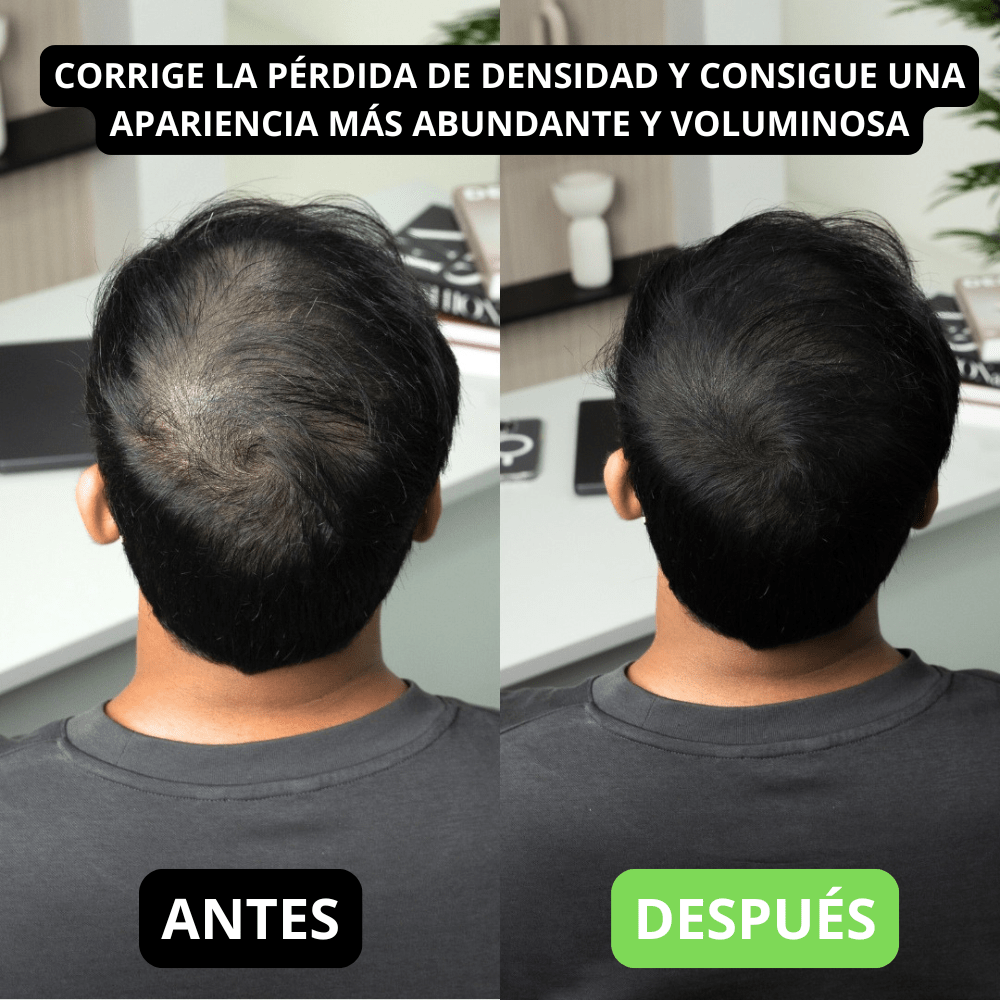 Hair Volume Powder for Men & women - Trendart